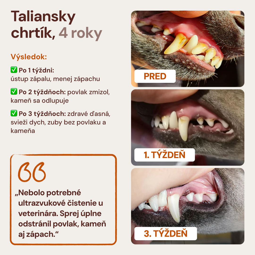 Lucaa+ Péče o zuby